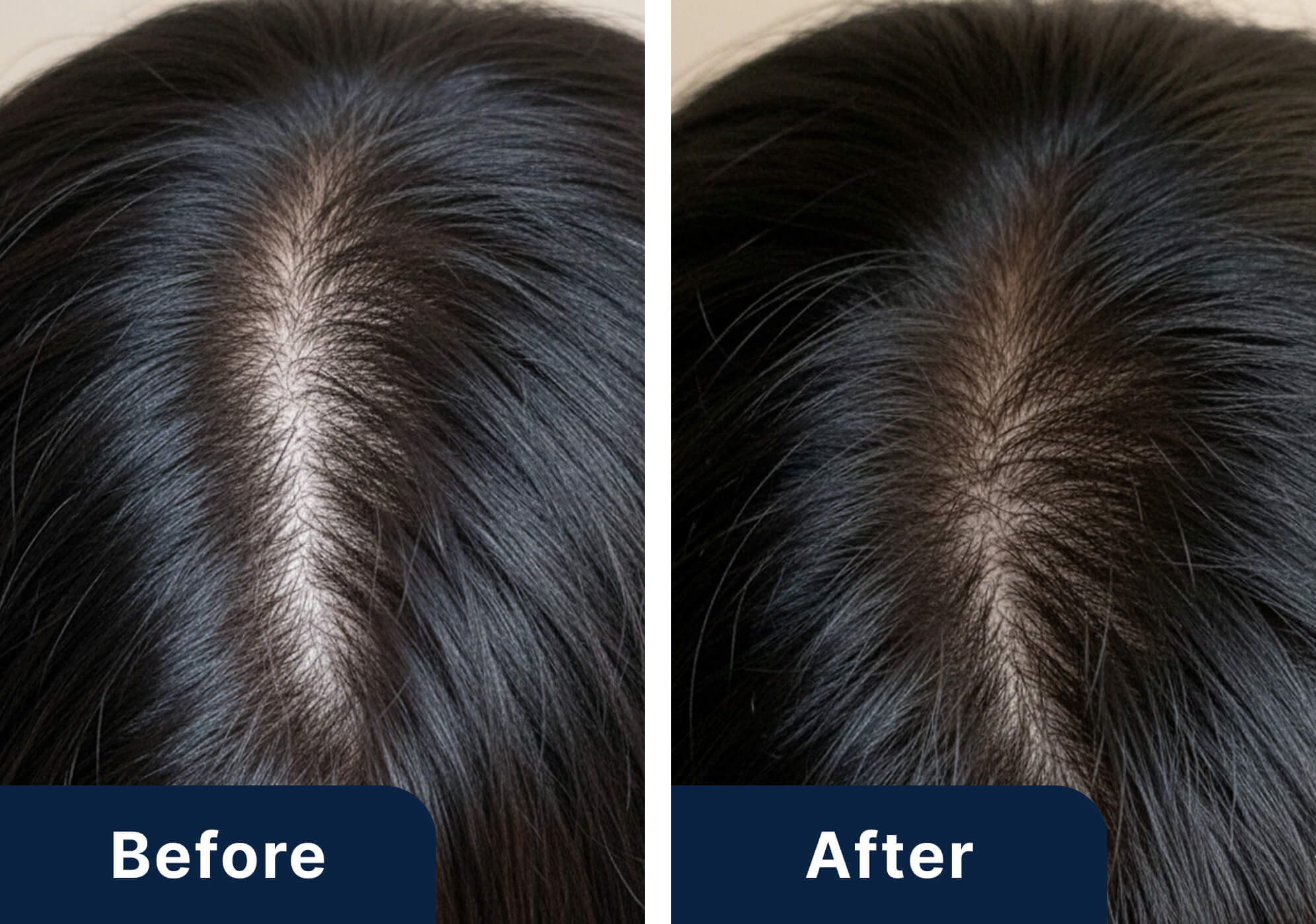 30代男性のビフォーアフター写真（施術3ヶ月）