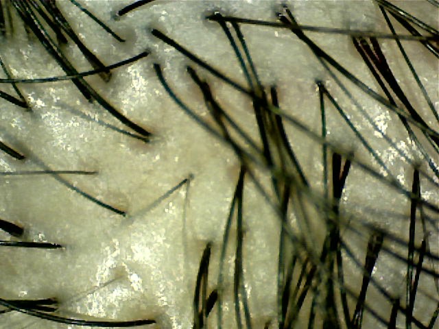 マイクロスコープで見た健康な頭皮